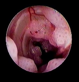 Endoscopie clinique vétérinaire Les Angles